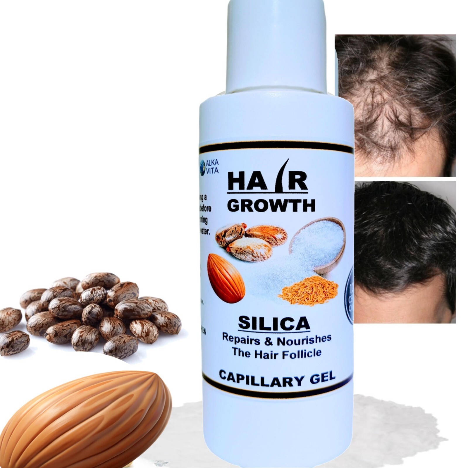 alkavita hair loss growth gel